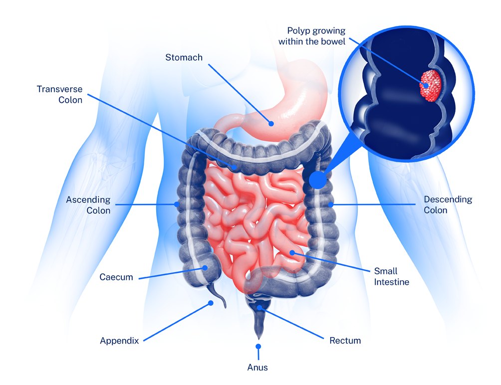 A diagram of the human bowel with the stomach, transverse colon, ascending colon, cecum, appendix, anus, rectum, small intestine and descending colon labelled.