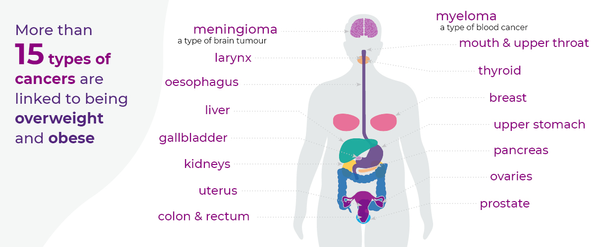 An infographic showing the body areas which are linked to more than 15 types of cancer