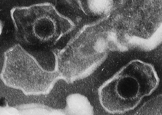 This electron microscopic image of two Epstein Barr Virus virions (viral particles) shows round capsids—protein-encased genetic material—loosely surrounded by the membrane envelope