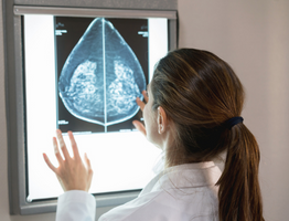 Breast Imaging Advanced Trainee Grant Program 2025 Round